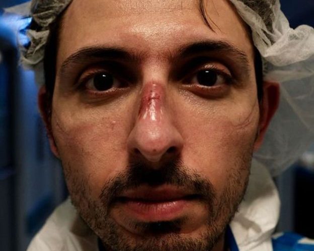 Italy’s Medical Workers: ‘We Became Heroes but They’ve Already Forgotten Us’